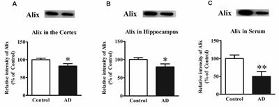 Alix: A Candidate Serum Biomarker of Alzheimer’s Disease